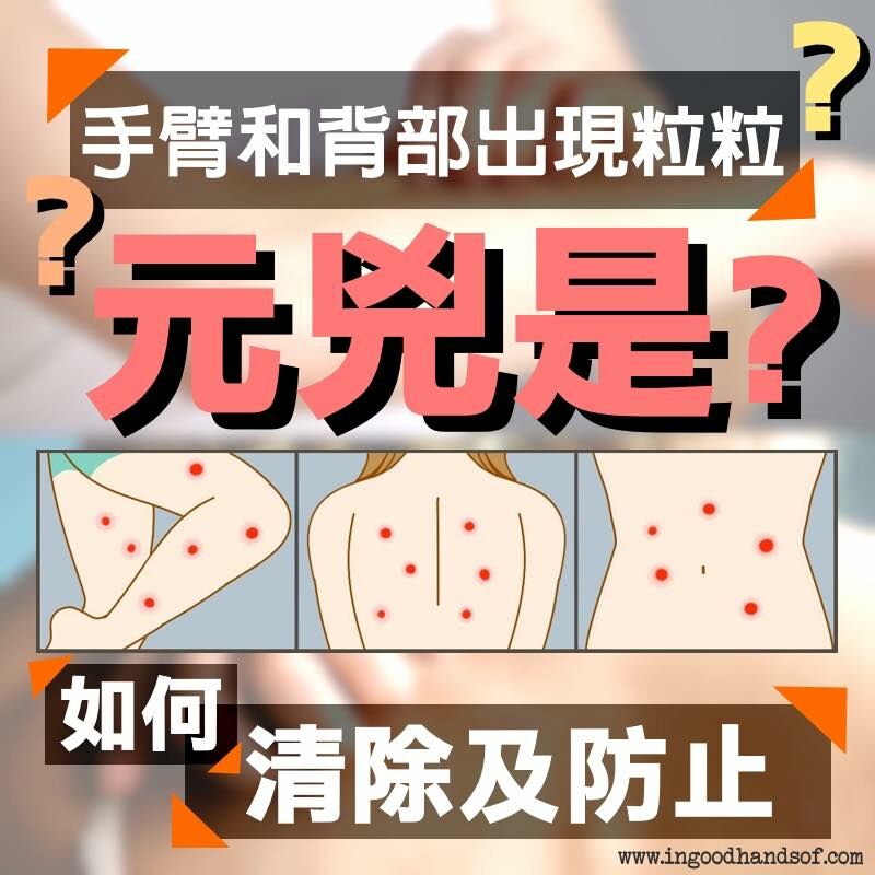 手臂和背部出現粒粒, 元兇是毛孔堵塞